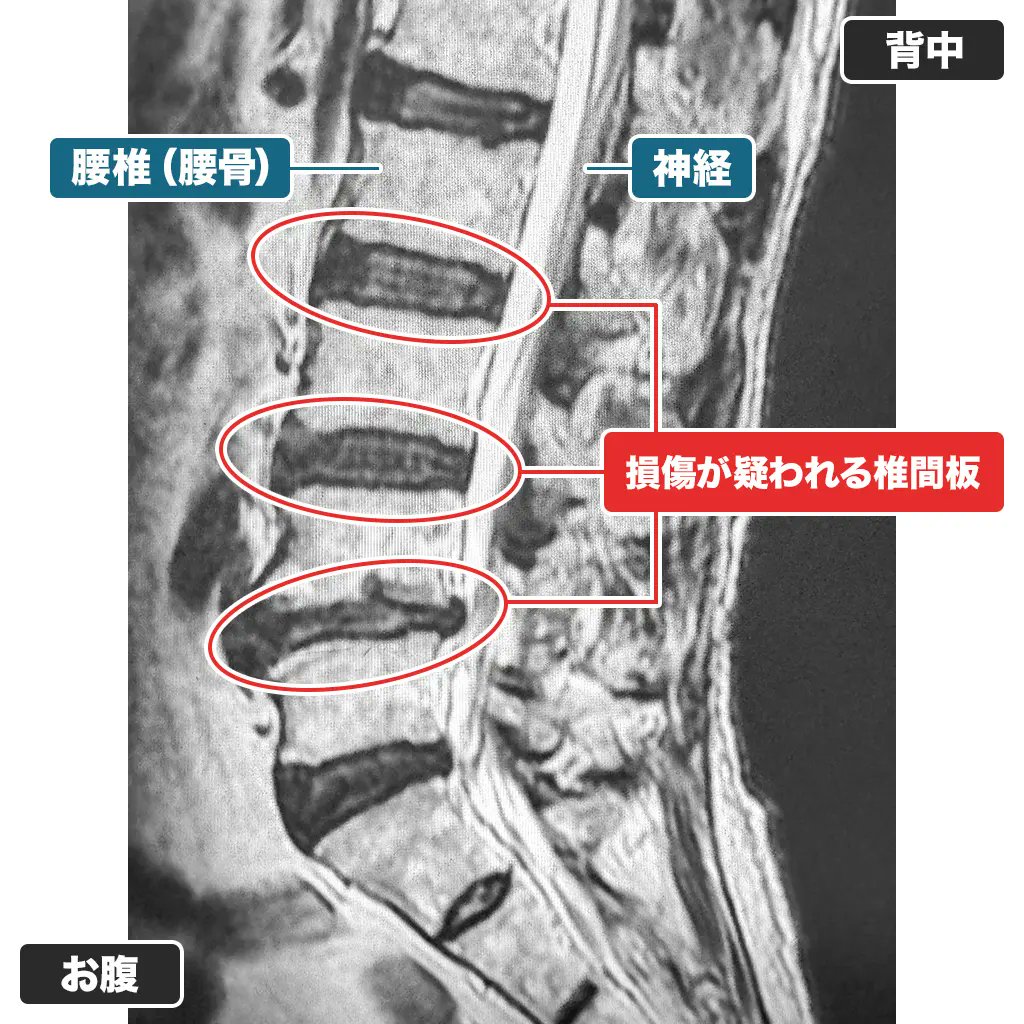 サクロフィックス®｜商品情報（医療関係者向け）