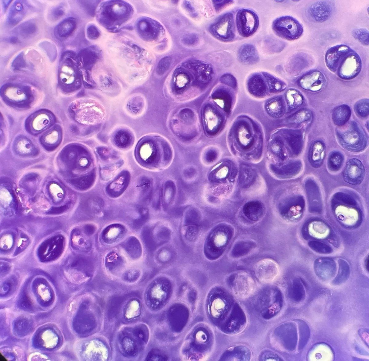 Chondrocytes in lacunae in a background of chondromucoprotein. What type of cartilage is seen? Answer: buff.ly/eDXt5Vb #PathArt #PathTwitter #MedTwitter