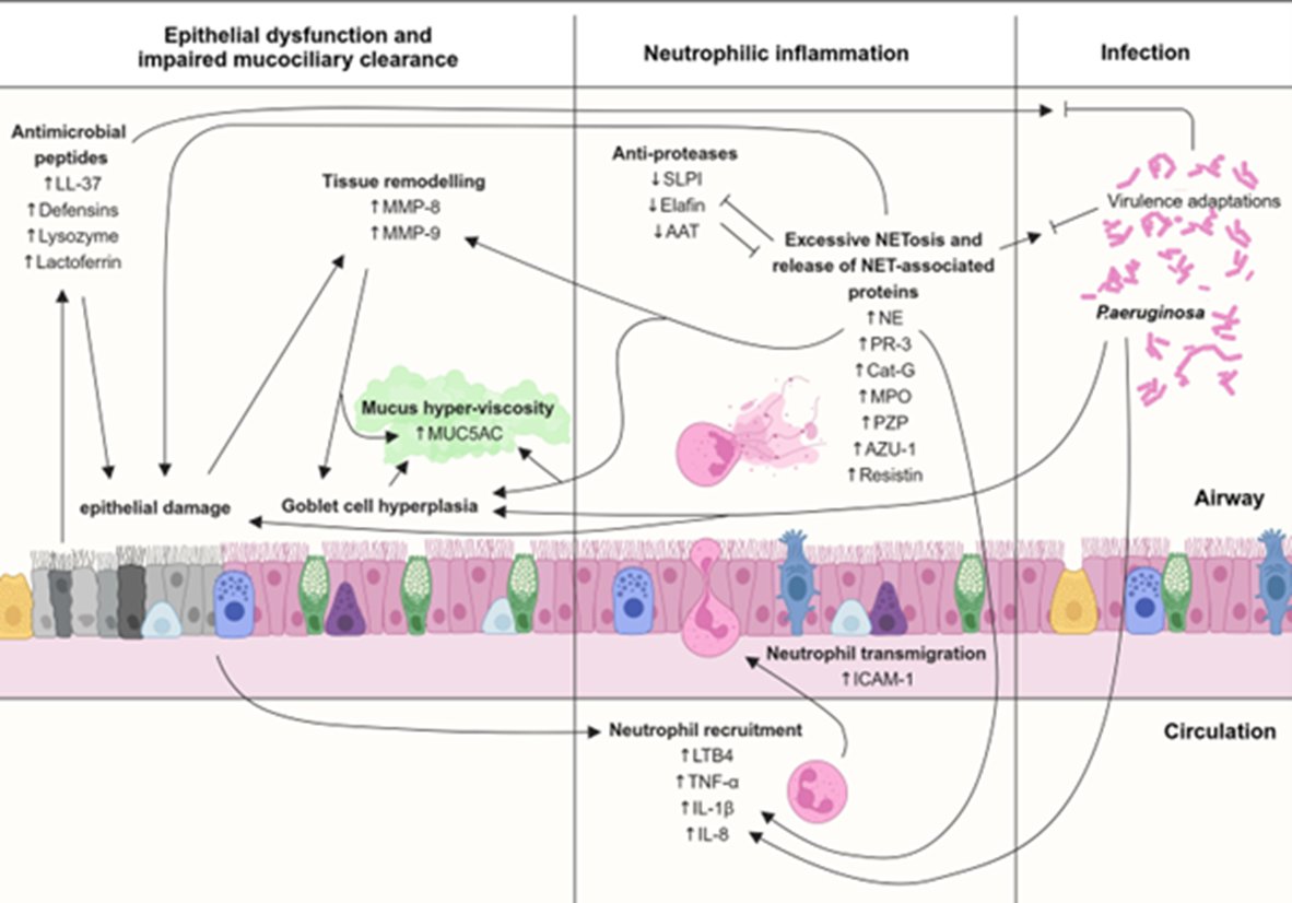James D Chalmers (@profjdchalmers) on Twitter photo Our brilliant team <a href="/UoDMedicine/">UoD Medicine</a> have shown that DPP1 inhibitors block multiple key inflammatory processes including reducing mucins/mucus, reducing pro-inflammatory proteins like azurocidin, and prevent protease cleavage of antimicrobial proteins
pubmed.ncbi.nlm.nih.gov/39938076/ Our brilliant team <a href="/UoDMedicine/">UoD Medicine</a> have shown that DPP1 inhibitors block multiple key inflammatory processes including reducing mucins/mucus, reducing pro-inflammatory proteins like azurocidin, and prevent protease cleavage of antimicrobial proteins
pubmed.ncbi.nlm.nih.gov/39938076/