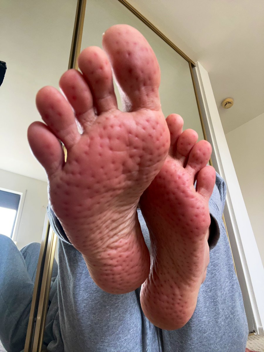 Key Sweet Feet (@key_sweetfeet) / Posts / X