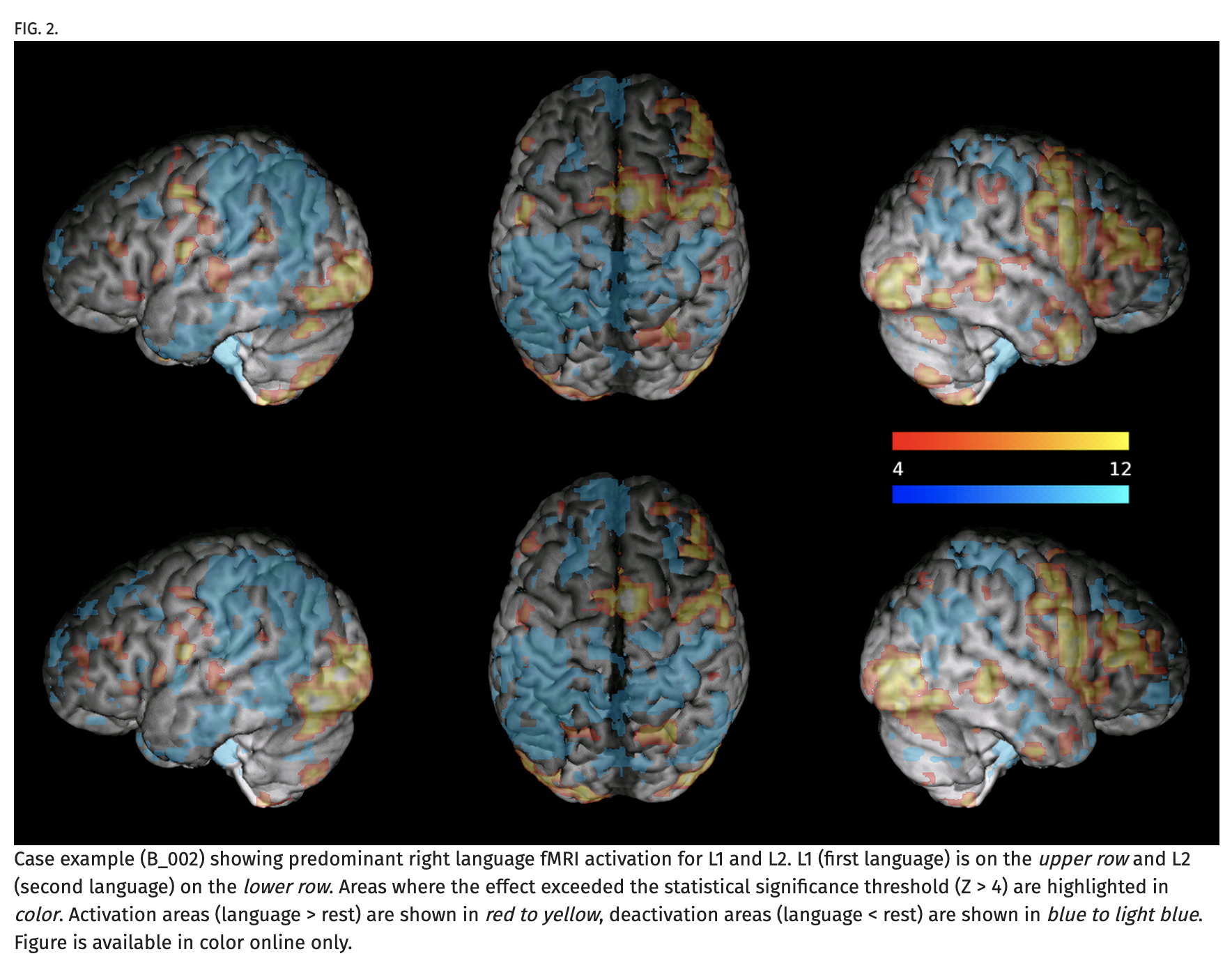 Journal of Neurosurgery (@TheJNS) / X