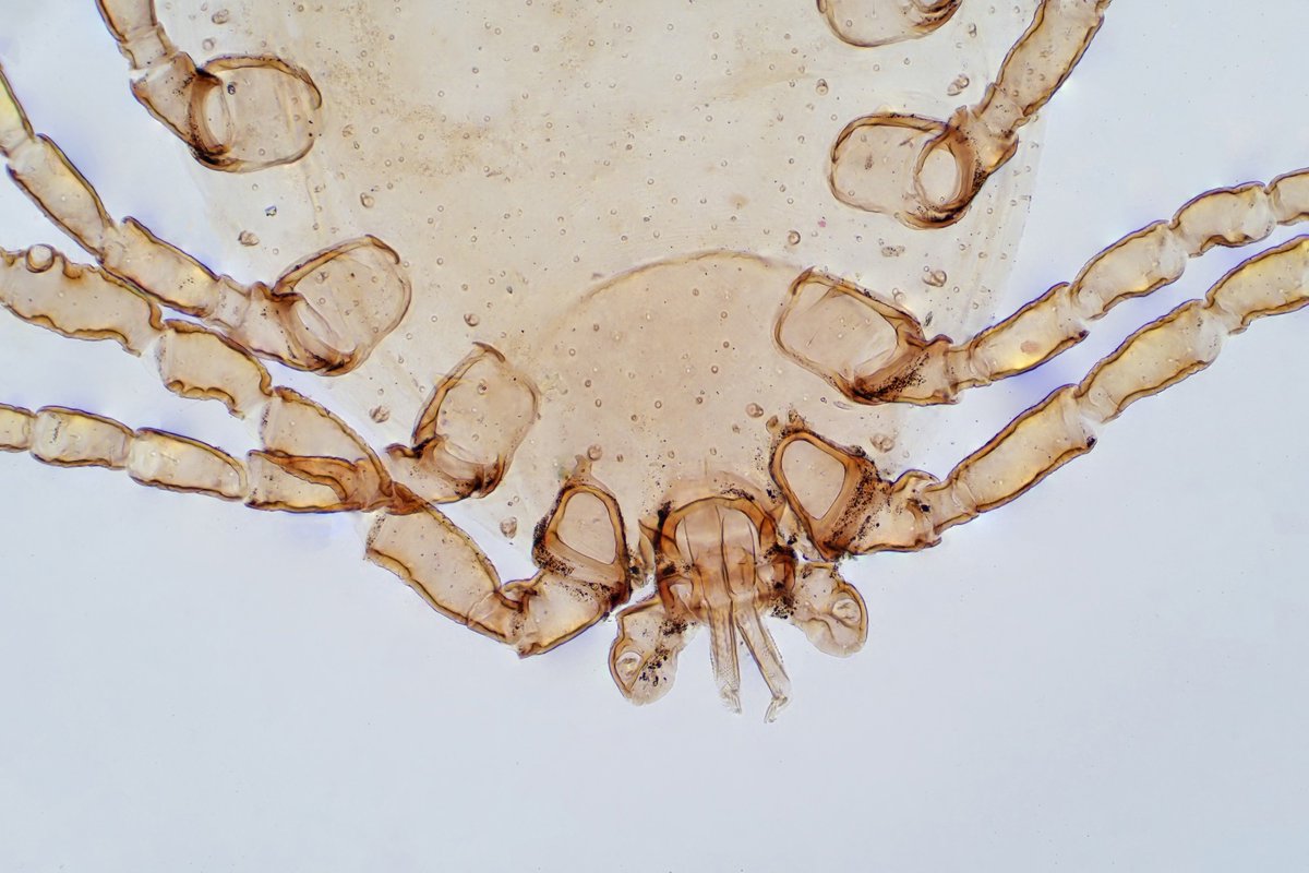 NewsMedical's tweet photo. What links dust mites, shellfish, and insect food allergies? 🦗🌬️🧪 https://t.co/i34n6H7wR0 #FoodAllergy #EdibleInsects #DustMites #CrossReactivity #Allergens #Immunology #Tenerife #MolecularDiagnostics #Tropomyosin #Nutrition @Nutrients_MDPI https://t.co/b3tA1jRWnE
