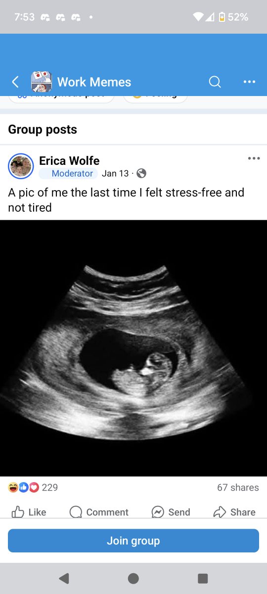 MochipantsDance's tweet photo. @PeetzofShit Check your sources better, bro. It's a stock image. She's not pregnant. https://t.co/vyrsNjaZN0