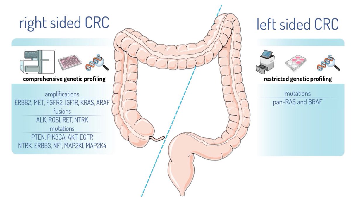 Goutham Sunny (@medoncodoc) on Twitter photo The ultimate review on Right vs Left CRC. Must read for residents.
doi.org/10.1038/s41698…
<a href="/todrashish/">Ashish Singh</a> <a href="/VikasO/">Prof Vikas Ostwal</a> <a href="/tuttsakhil/">Dr Akhil Santhosh</a> <a href="/SuyogCancer/">Dr Amol Akhade</a> <a href="/AnantRamaswamy/">Anant Ramaswamy</a> <a href="/shaunak_3/">Valame MD DNB</a> <a href="/pashtoonkasi/">Pashtoon Kasi MD, MS</a> The ultimate review on Right vs Left CRC. Must read for residents.
doi.org/10.1038/s41698…
<a href="/todrashish/">Ashish Singh</a> <a href="/VikasO/">Prof Vikas Ostwal</a> <a href="/tuttsakhil/">Dr Akhil Santhosh</a> <a href="/SuyogCancer/">Dr Amol Akhade</a> <a href="/AnantRamaswamy/">Anant Ramaswamy</a> <a href="/shaunak_3/">Valame MD DNB</a> <a href="/pashtoonkasi/">Pashtoon Kasi MD, MS</a>