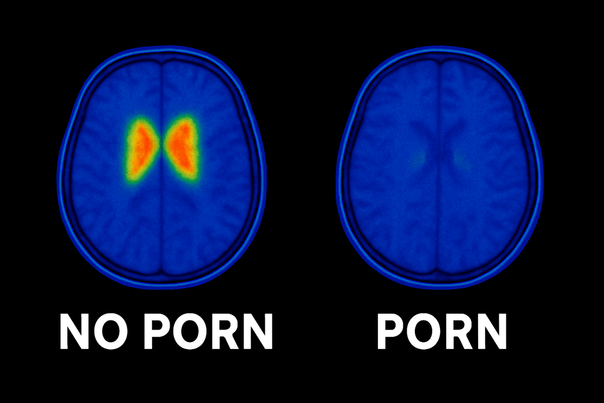 TeriqPhillips's tweet photo. The most misunderstood drug in the world:

P*rn.

Billions of men think p*rn is healthy but xxx is killing their dreams, souls and happiness.

Here’s how p*rn rewires your brain: (backed by science): https://t.co/F4IAukvYyT