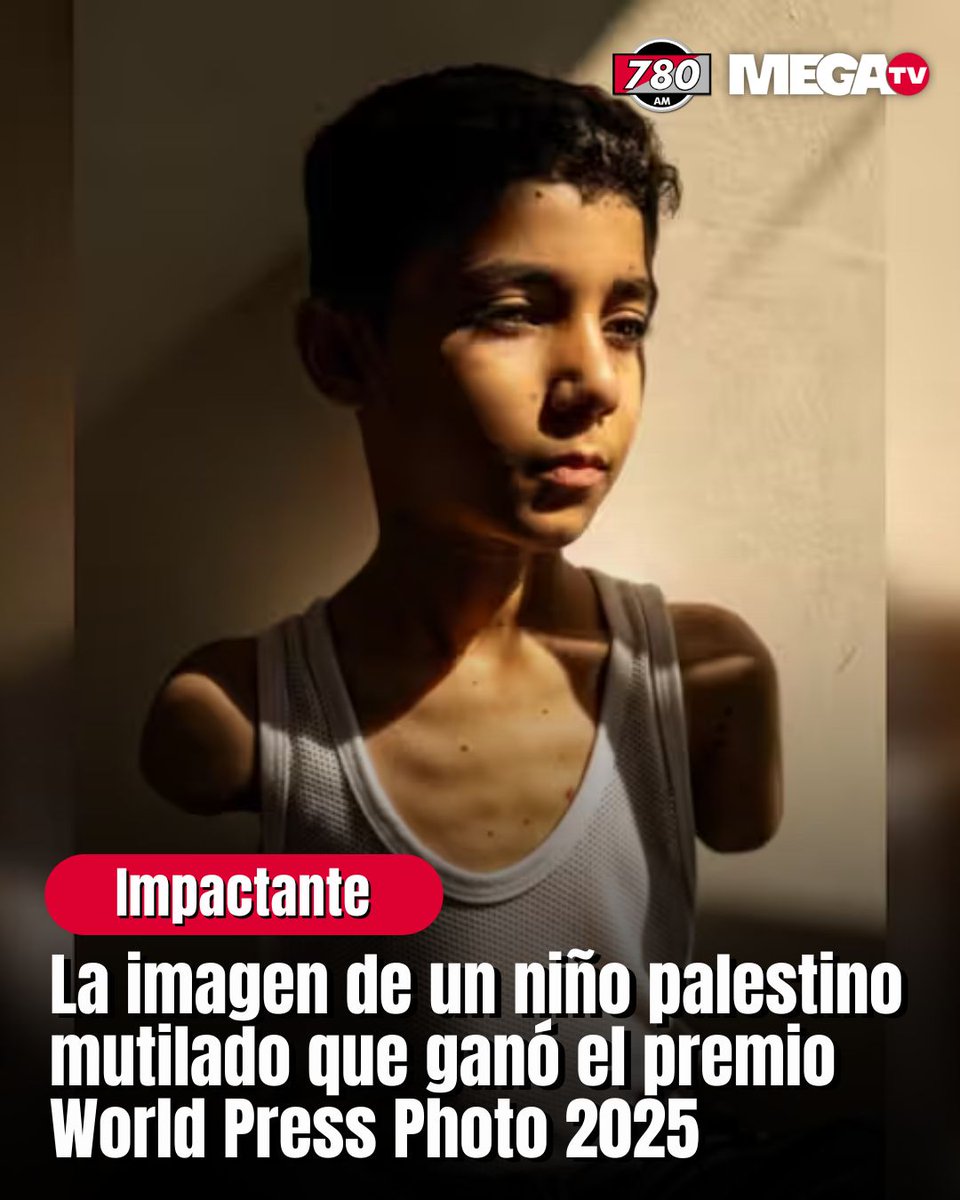 LA IMPACTANTE IMAGEN DE UN NIÑO PALESTINO MUTILADO QUE GANÓ EL PREMIO WORLD PRESS PHOTO 2025 📸

😓El rostro de Mahmoud Ajjour, de solo 9 años, y las consecuencias de la guerra sobre su cuerpo están en todos lados.

🎖️Una fotografía suya, hecha por Samar Abu Elouf, también