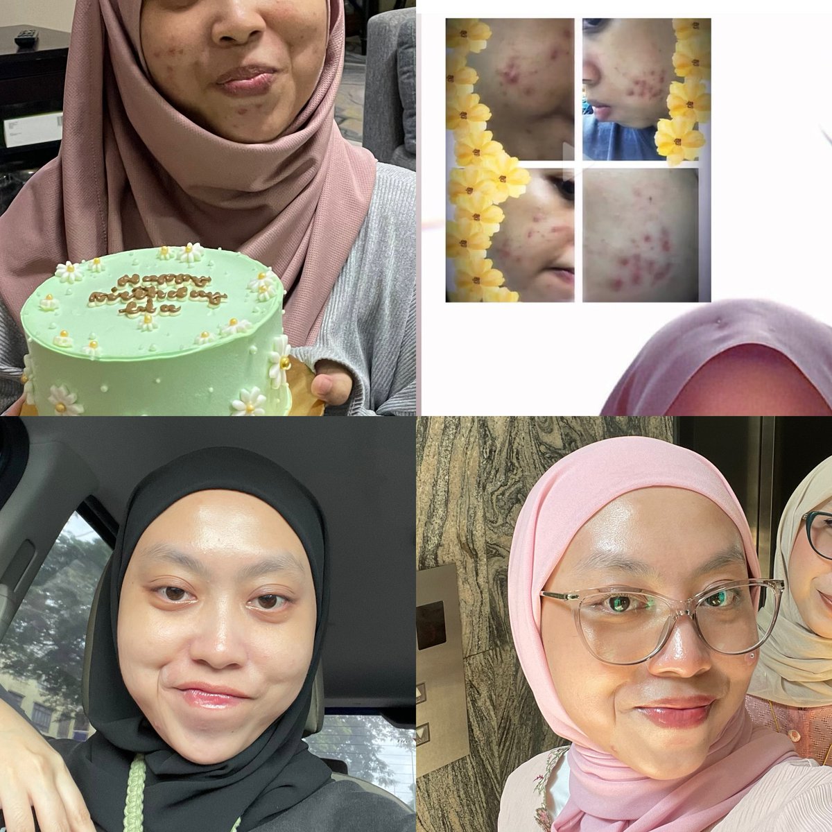 coffeeorcola's tweet photo. Siapa kata you need facial treatment untuk dapat good skin?

With the right skincare + consistency = skin goals unlocked

Here’s what I use to get that post facial glow. (still $$$, but lasts way longer than 1 session 😬) https://t.co/0ZVx87Ruko