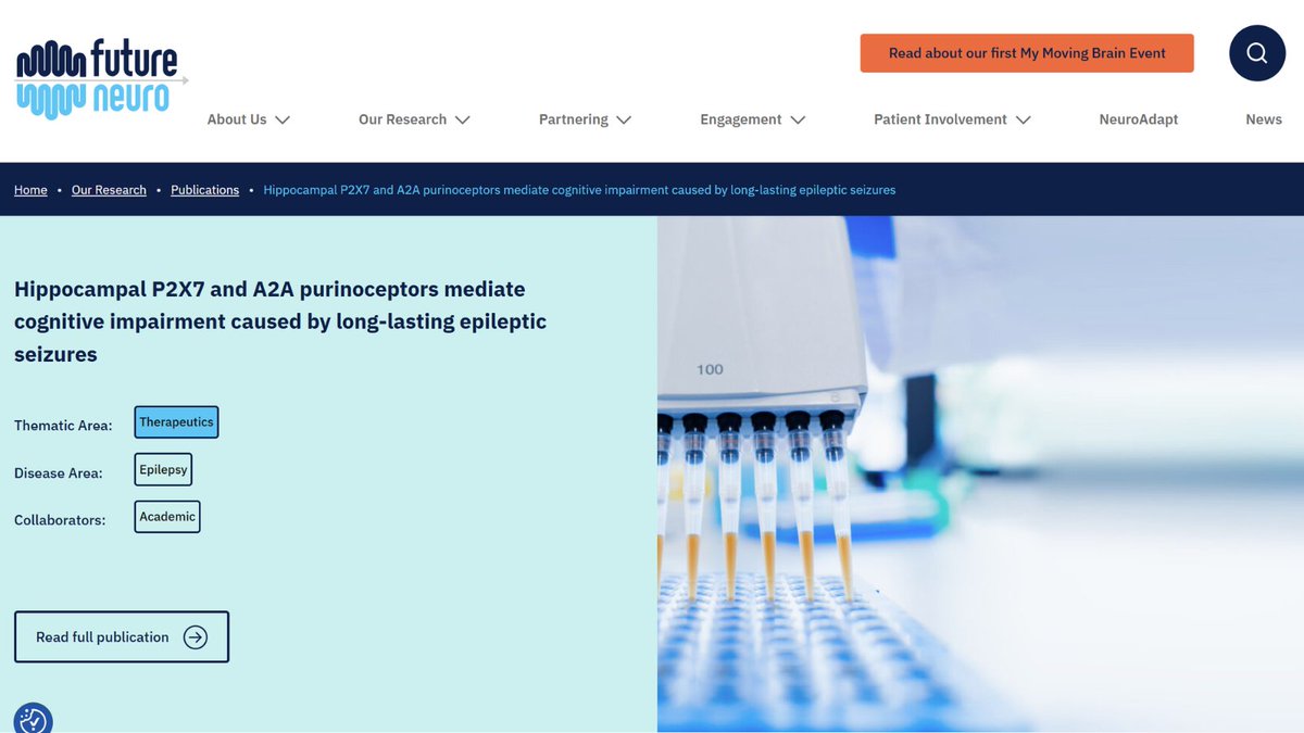 FutureNeuro Centre (@futureneuro_ie) on Twitter photo 📄New research from <a href="/Futureneuro_ie/">FutureNeuro Centre</a> shows that targeting purinergic receptors may help reduce seizures and improve cognition in drug-resistant epilepsy. Read more: futureneurocentre.ie/publications/h… 📄New research from <a href="/Futureneuro_ie/">FutureNeuro Centre</a> shows that targeting purinergic receptors may help reduce seizures and improve cognition in drug-resistant epilepsy. Read more: futureneurocentre.ie/publications/h…