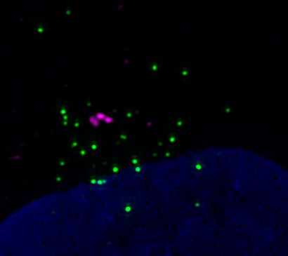 Shweta Tyagi (@shwetatyagicdfd) on Twitter photo Stop obsessing over PCM1 !! There is a new kid on the block 🕺👇🏻
Read our review about "CEP72", the centriolar satellite 🛰️ protein to watch for
doi.org/10.1002/cm.220…
#centrosome, #Mitosis, #CellBiology
<a href="/AshwinDalal9/">Ashwin Dalal</a>, @DBT_CDFD ,<a href="/CytoskelJournal/">Cytoskeleton Journal</a> Stop obsessing over PCM1 !! There is a new kid on the block 🕺👇🏻
Read our review about "CEP72", the centriolar satellite 🛰️ protein to watch for
doi.org/10.1002/cm.220…
#centrosome, #Mitosis, #CellBiology
<a href="/AshwinDalal9/">Ashwin Dalal</a>, @DBT_CDFD ,<a href="/CytoskelJournal/">Cytoskeleton Journal</a>