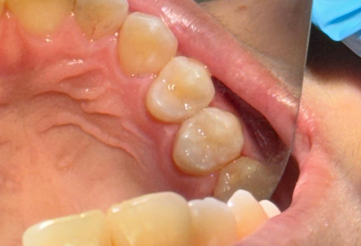 #15 class ll CE restoration 

Perfect ending to a longgg week