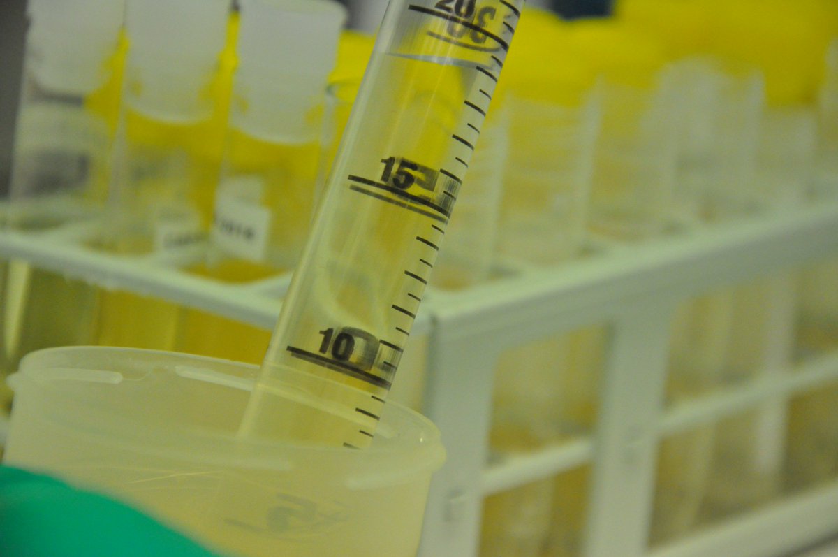 📌¿Quién puede participar?
🔹Profesionales implicados en el diagnóstico, tratamiento o seguimiento
🔹Personas afectadas por SLOS (menores y adultos)
🔹Personas sanas para el estudio comparativo

📌¿Qué implica la participación?
Donar una muestra de sangre y una de saliva