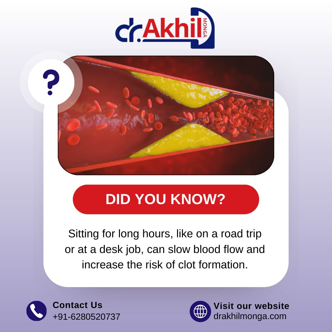 It’s important to take regular breaks, stretch, and stay active to prevent DVT!

📞 +91-6280520737 🌐 drakhilmonga.com
.
.
#DrAkhilMonga#DVTawareness #DeepVeinThrombosis #BloodClotPrevention #VascularHealth #StaySafe #KnowTheSigns #HealthyVeins #PreventionIsKey
