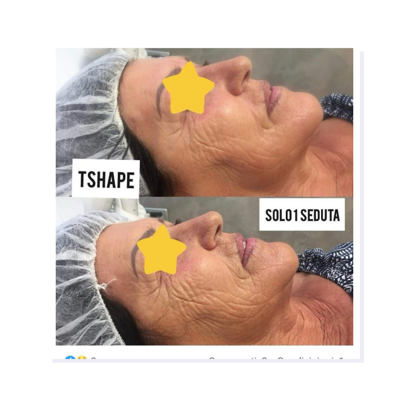 Our newest T-Shape 2 machine from Europe has a multifunctional shaping system that combines different technologies to address aesthetic concerns on both the face and body. 

(Follow the link to learn more at l8r.it/yq03)

Call us today 954.703.4499