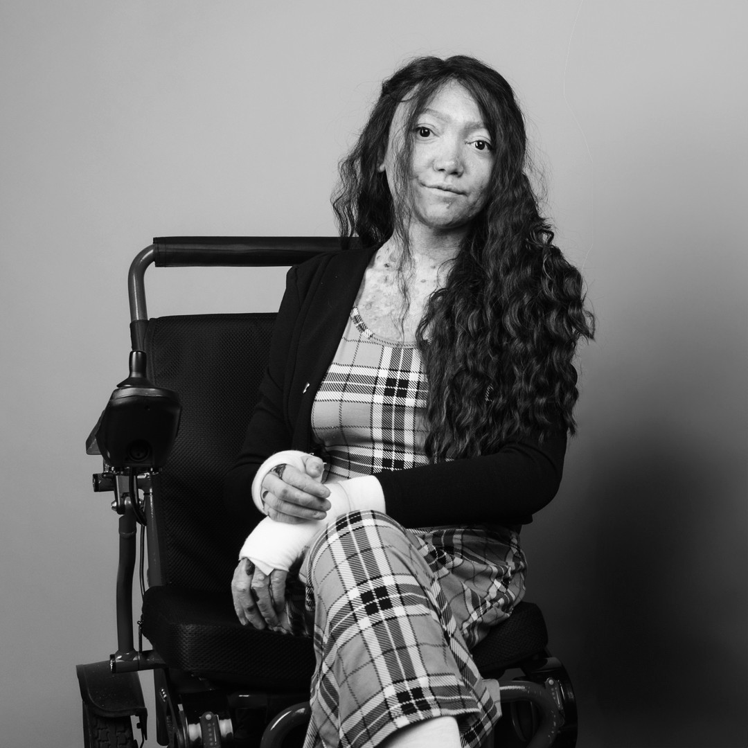 It is with our deepest condolences that we share the passing of Shardai Cousino, a strong and beautiful voice of the EB community. 🦋 💙  

We were honored to have her as a guest at Venture Into Cures Seattle and we will always remember her spirit and legacy.   

EB Research