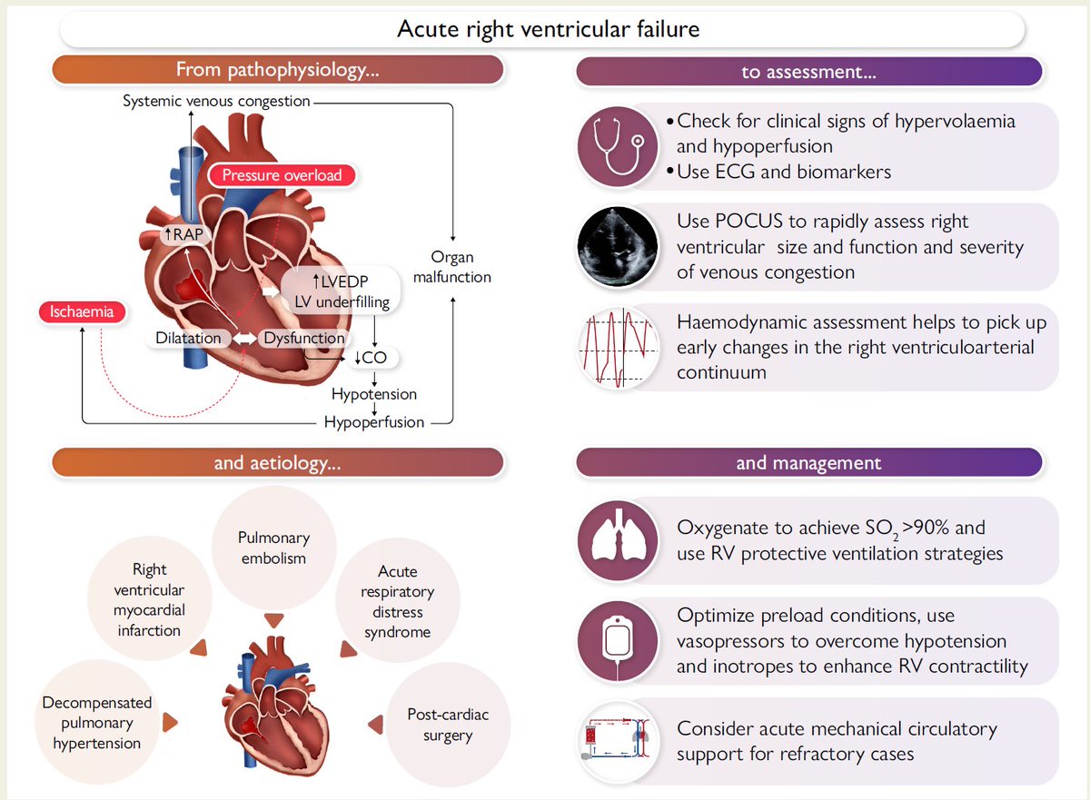 Frederik H. Verbrugge (@fh_verbrugge) on Twitter photo What a great pleasure to review the topic of acute #ThePeoplesVentricle failure together with some great colleagues <a href="/ESC_Journals/">European Society of Cardiology Journals</a>.
academic.oup.com/eurheartj/arti…
<a href="/GGiannakoulas/">George Giannakoulas</a> <a href="/RyanTedfordMD/">Ryan J Tedford MD</a>
Tweetorial 👇 What a great pleasure to review the topic of acute #ThePeoplesVentricle failure together with some great colleagues <a href="/ESC_Journals/">European Society of Cardiology Journals</a>.
academic.oup.com/eurheartj/arti…
<a href="/GGiannakoulas/">George Giannakoulas</a> <a href="/RyanTedfordMD/">Ryan J Tedford MD</a>
Tweetorial 👇