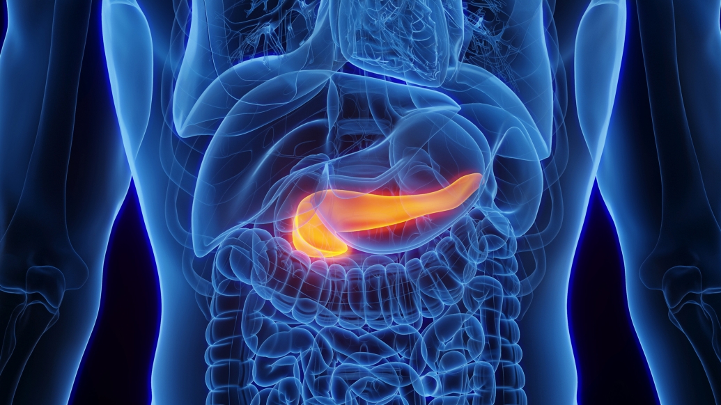 Pancreatic cancer is a leading cause of cancer-related death. The high mortality is largely due to a lack of effective therapy options. 

U-M researchers have discovered that simultaneously targeting two key pathways can eliminate tumors: michmed.org/Zx7wD.