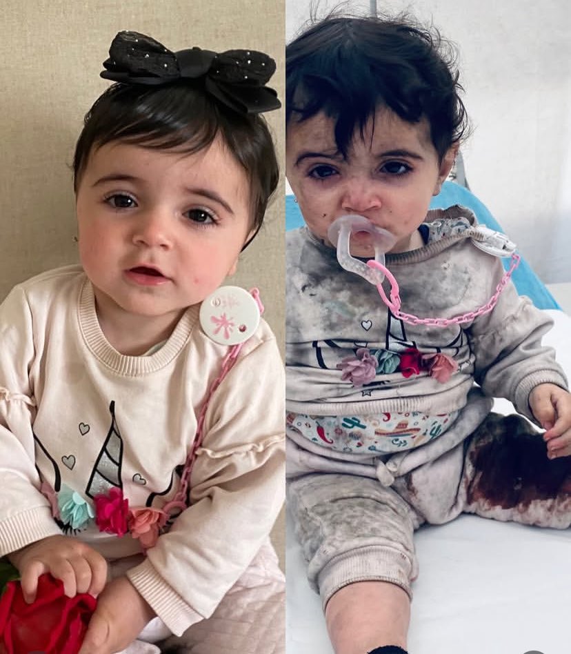 Ceninlerdeki evlatlara kadar katleden İsrail, kendisine kimse başkaldırmadığı için cesaret buluyor. Bu çocuklar hepimizin, insanlığın, iyiliğin geleceği. Ne zaman harekete geçilecek? 

#wakeupmuslim