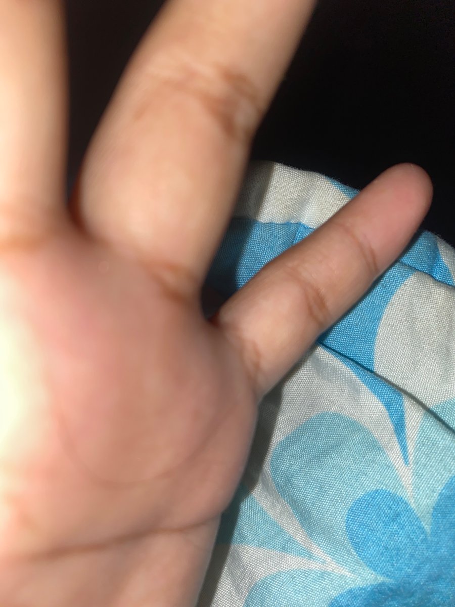 putri_bung's tweet photo. Pada akhirnya saya kembali ke tempat yang membuat saya tidak nyaman untuk hidup tapi tidak ada pilihan lain. https://t.co/pbkHrtF766