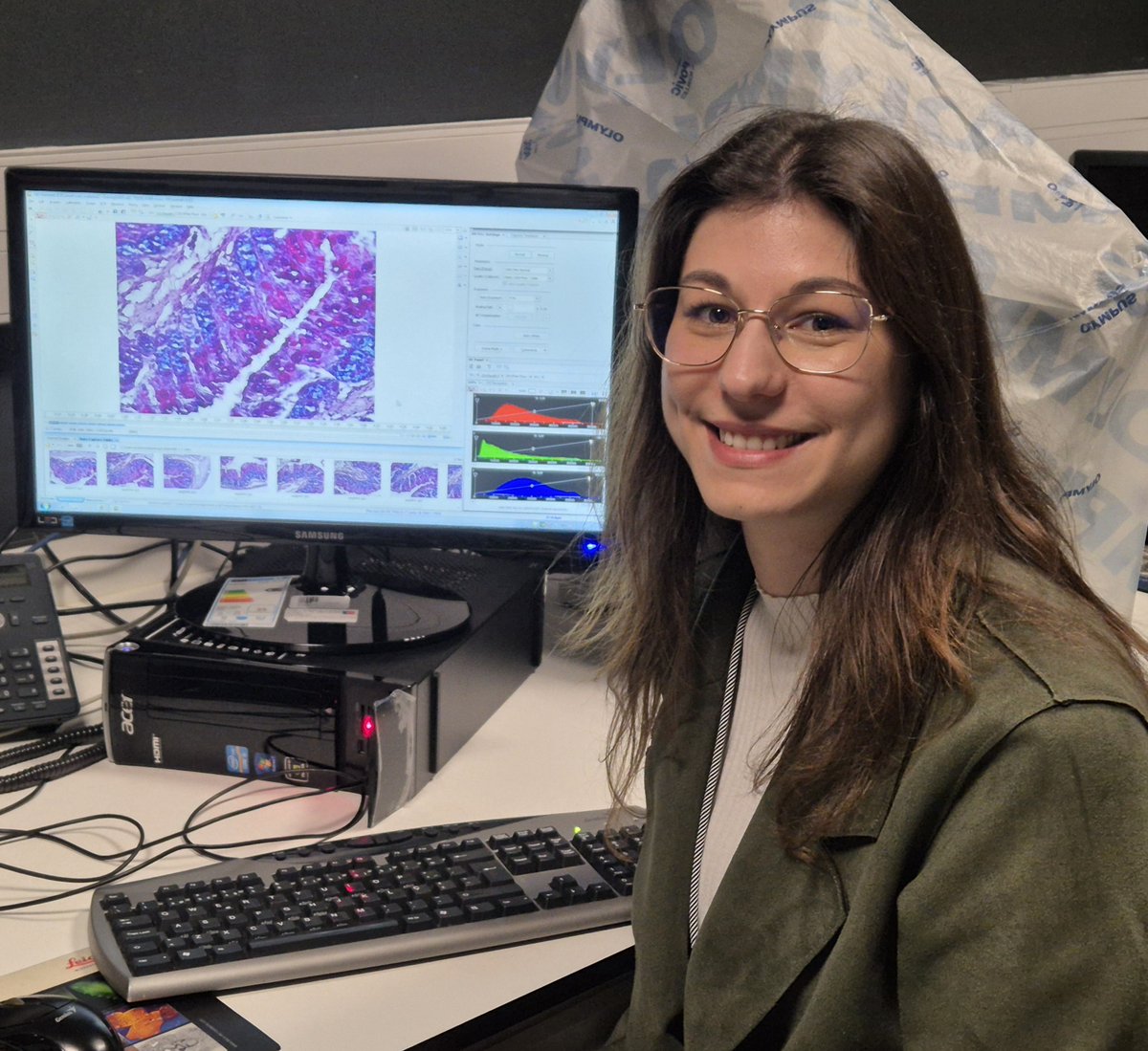 PPBioImaging's tweet image. What does your gut say about aging?
That’s what Catarina Silva, a PhD student @ibimed_ua , is working to uncover.
Her research dives into inflammaging -the chronic, low-grade inflammation that comes with age- and how it shapes the gut microbiota.🦠