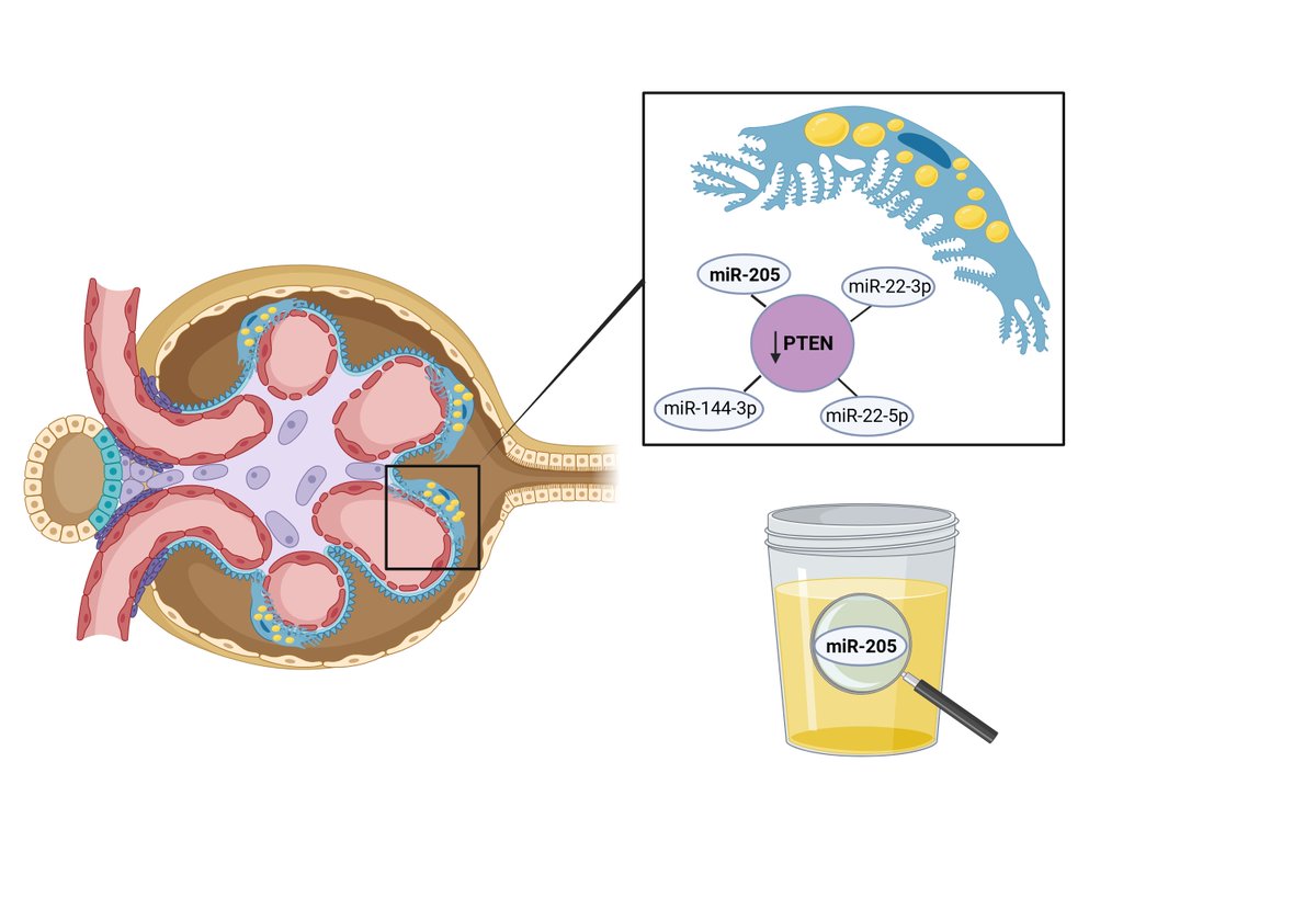 Marina López Martínez (@marinalopezmtez) on Twitter photo The Role of miRNAs as Early Biomarkers in Obesity-Related Glomerulopathy: Implications for Early Detection and Treatment. <a href="/marunavarrodiaz/">Maru Navarro Díaz</a>
doi.org/10.3390/biomed… The Role of miRNAs as Early Biomarkers in Obesity-Related Glomerulopathy: Implications for Early Detection and Treatment. <a href="/marunavarrodiaz/">Maru Navarro Díaz</a>
doi.org/10.3390/biomed…