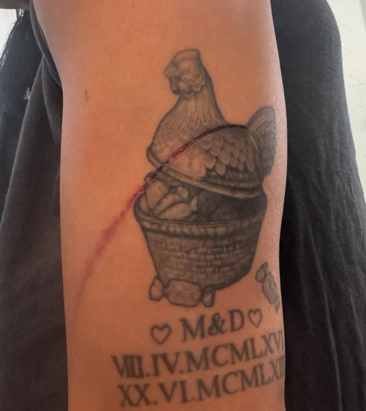 La ferita sul braccio della Mami (Foto: @rhearipley_wwe)