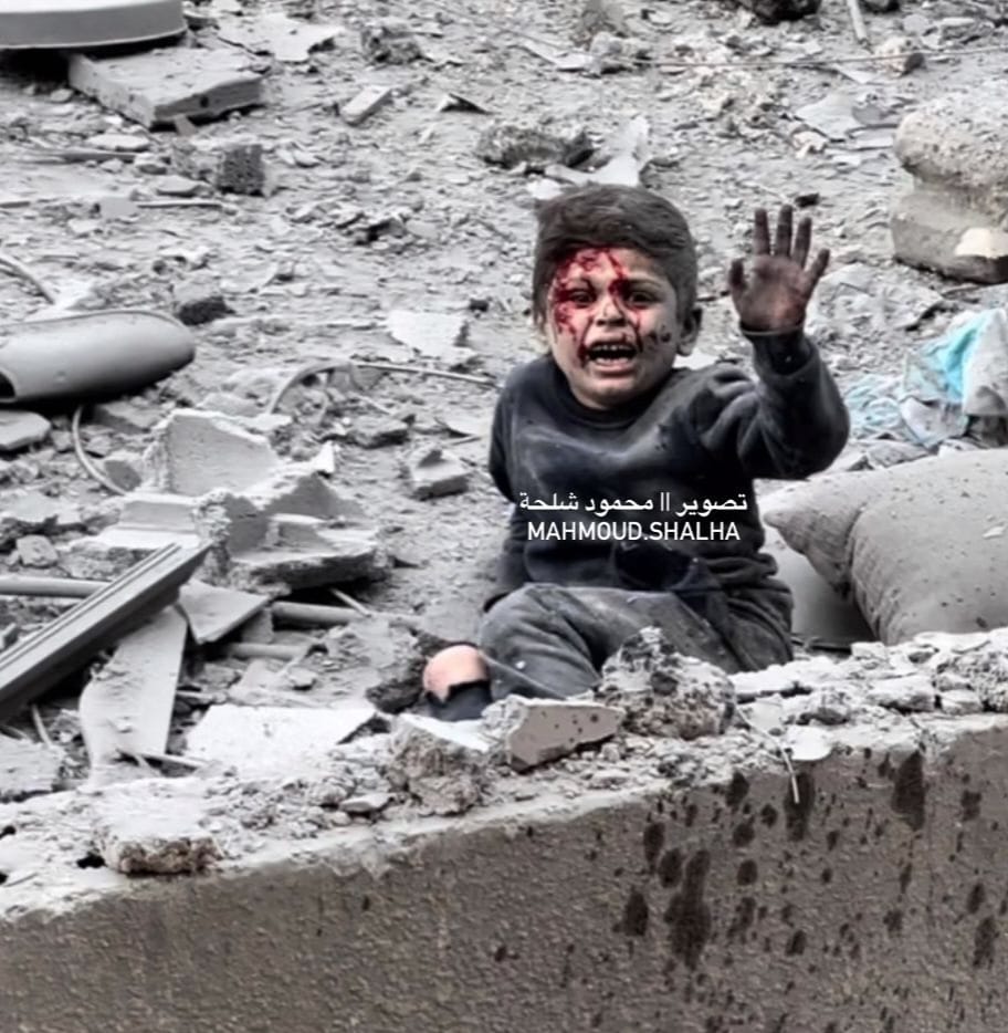 خذلان الأمة لغزة في صورة
هذا الطفل، علي فرج فرج، نجا بأعجوبة من مجزرة ارتكبتها طائرات الاحتلال الإسرائيلي شمال غزة، استُشهد خلالها والده وخمس من شقيقاته، فيما أُصيبت والدته بجراح بالغة.