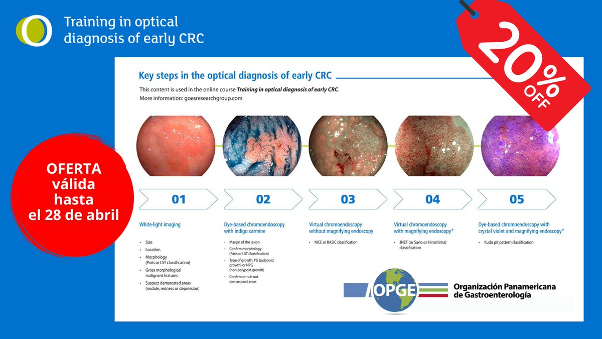 TOD early CRC (@todearlycrc) on Twitter photo 📣 ¡Atención, socios de <a href="/OPGEgastro/">Organización Panamericana de Gastroenterología</a>!
Hasta el lunes 👉 2️⃣0️⃣ % de DESCUENTO en los cursos de <a href="/todearlycrc/">TOD early CRC</a> 🔥
🧠 Aprende a identificar el patrón invasivo en pólipos colorrectales y transforma tu práctica clínica con herramientas de vanguardia.
👉 opge.org/?p=3895 📣 ¡Atención, socios de <a href="/OPGEgastro/">Organización Panamericana de Gastroenterología</a>!
Hasta el lunes 👉 2️⃣0️⃣ % de DESCUENTO en los cursos de <a href="/todearlycrc/">TOD early CRC</a> 🔥
🧠 Aprende a identificar el patrón invasivo en pólipos colorrectales y transforma tu práctica clínica con herramientas de vanguardia.
👉 opge.org/?p=3895