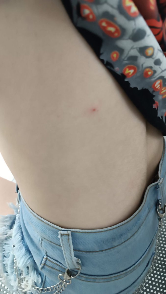 🚨 Siguen los “piquetes” en el <a href="/MetroCDMX/">MetroCDMX</a>. Una usuaria relata que la drogaron en la línea 2: “Alguien me pegó en la espalda y pensé que era por qué había mucha gente…  me empezó a arder el pique y tenía sangre, me temblaban las piernas y empecé a sudar mucho. Llegando a casa