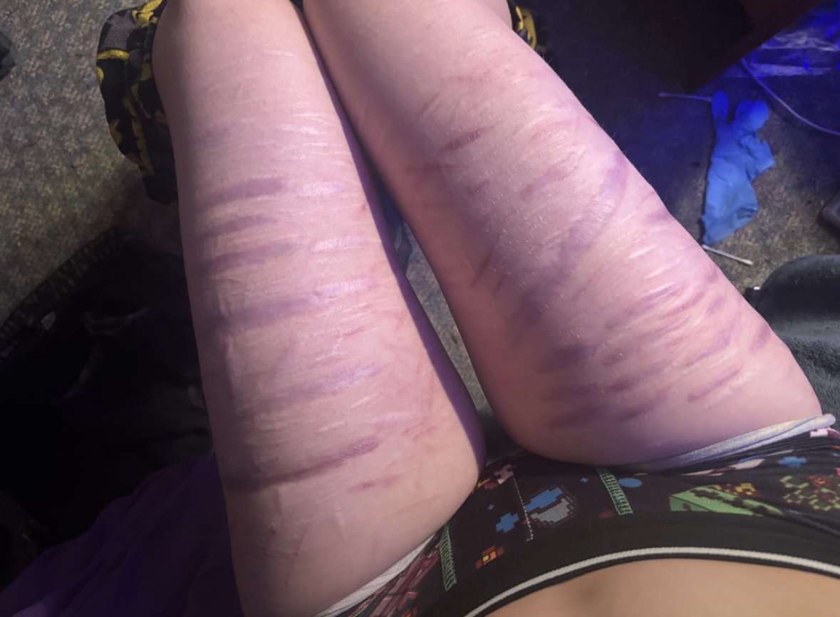 velvetrial's tweet photo. Going deeper will not make you feel any more valid. these pics are 2 years apart and i feel way less valid now, people romanticize going deeper but in reality you feel worse https://t.co/6aOji37Bdi