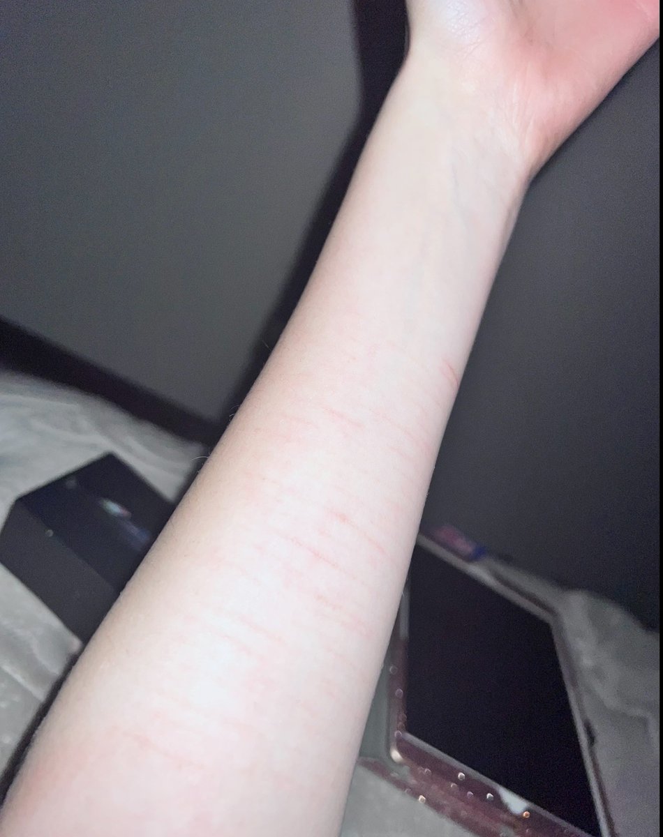 velvetrial's tweet photo. Going deeper will not make you feel any more valid. these pics are 2 years apart and i feel way less valid now, people romanticize going deeper but in reality you feel worse https://t.co/6aOji37Bdi