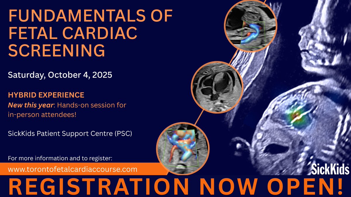 SickKids Labatt Family Heart Centre (@skheartcentre) on Twitter photo 🌟Join us for Fundamentals of Fetal Cardiac Screening! A 1-day course with lectures, interactive cases, & hands-on sessions!!🩺👶
<a href="/CHEO/">CHEO Ottawa</a> <a href="/Sunnybrook/">Sunnybrook Health Sciences Centre</a> <a href="/UnityHealthTO/">Unity Health Toronto</a>
📅 Date: Oct 4, 2025
📍 Location: 175 Elizabeth Street
#FetalCardiology
👉 Register today: ww.torontofetalcardiaccourse.com 🌟Join us for Fundamentals of Fetal Cardiac Screening! A 1-day course with lectures, interactive cases, & hands-on sessions!!🩺👶
<a href="/CHEO/">CHEO Ottawa</a> <a href="/Sunnybrook/">Sunnybrook Health Sciences Centre</a> <a href="/UnityHealthTO/">Unity Health Toronto</a>
📅 Date: Oct 4, 2025
📍 Location: 175 Elizabeth Street
#FetalCardiology
👉 Register today: ww.torontofetalcardiaccourse.com