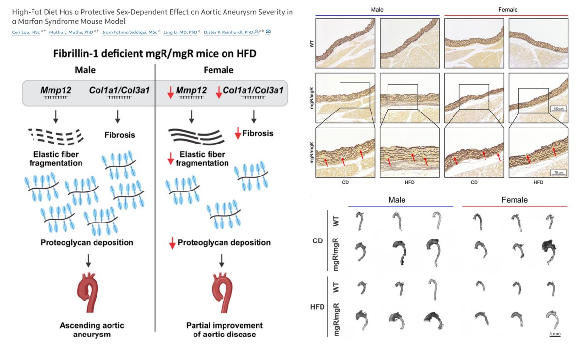 HaoYin20's tweet photo. #HighFatDiet (60% fat w/o extra cholesterol or cholic acid) protects Marfan Aortopathy in♀️, not♂️, mgR/mgR🐭
⏬thoracic aortic diameter
⏬elastin fragmentation
⏬MMP12 Col1a1
↔️proteoglycan

Any benefit on Lifespan or #AorticDissection?😃

#AortaEd
@dkpreinhardt @CJCJournals 2023
https://t.co/6TSgq2RsgG