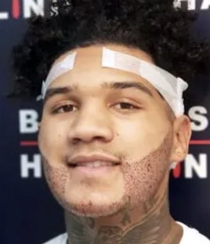 BoxingShrew's tweet image. “Have you been to British Hair Clinic? It changed my life, and my beard”

Conor B, client