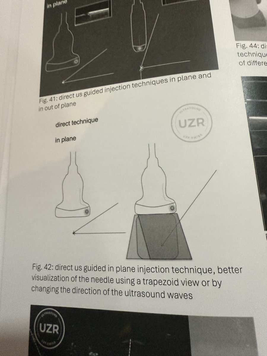 Thanks to modern matrix probes nowadays , we can steer the ultrasound beam without moving the probe,,,this helps keep the target in view while improving needle visibility during injections

Reference:
UZR. SONOANATOMY High-Resolution Atlas: Ultrasound of the MSK System.