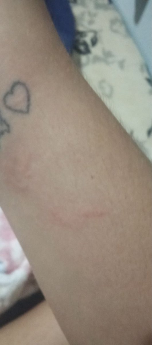 MKotehok's tweet photo. Ele literalmente veio até mim e partiu pra cima de mim, arrancou meu telefone da minha mão, tudo na presença de uma criança, me agrediu diversas vezes e deixou meus pulsos todos marcados porque me segurou com toda a força por eles pra eu nao pegar meu telefone de volta nem reagir https://t.co/46xmeHghBZ
