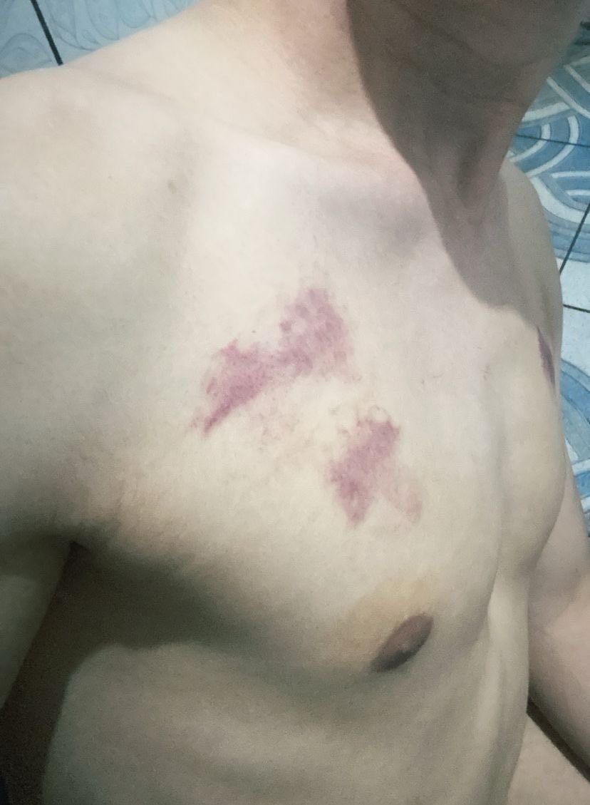 Como vocês ficam pós-relação?🥺