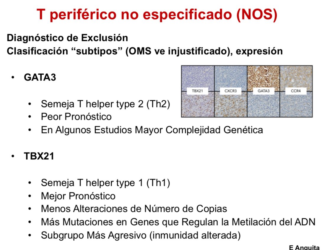 Preciosa sesión sobre #linfoma T periférico NOS GATA3+ esta tarde en nuestra reunión académica de #OnHePreS <a href="/ucc_complutense/">Unidad de Cultura Científica UCM</a> <a href="/SYNLAB_ES/">SYNLAB España</a>, revisión y un caso espectacular