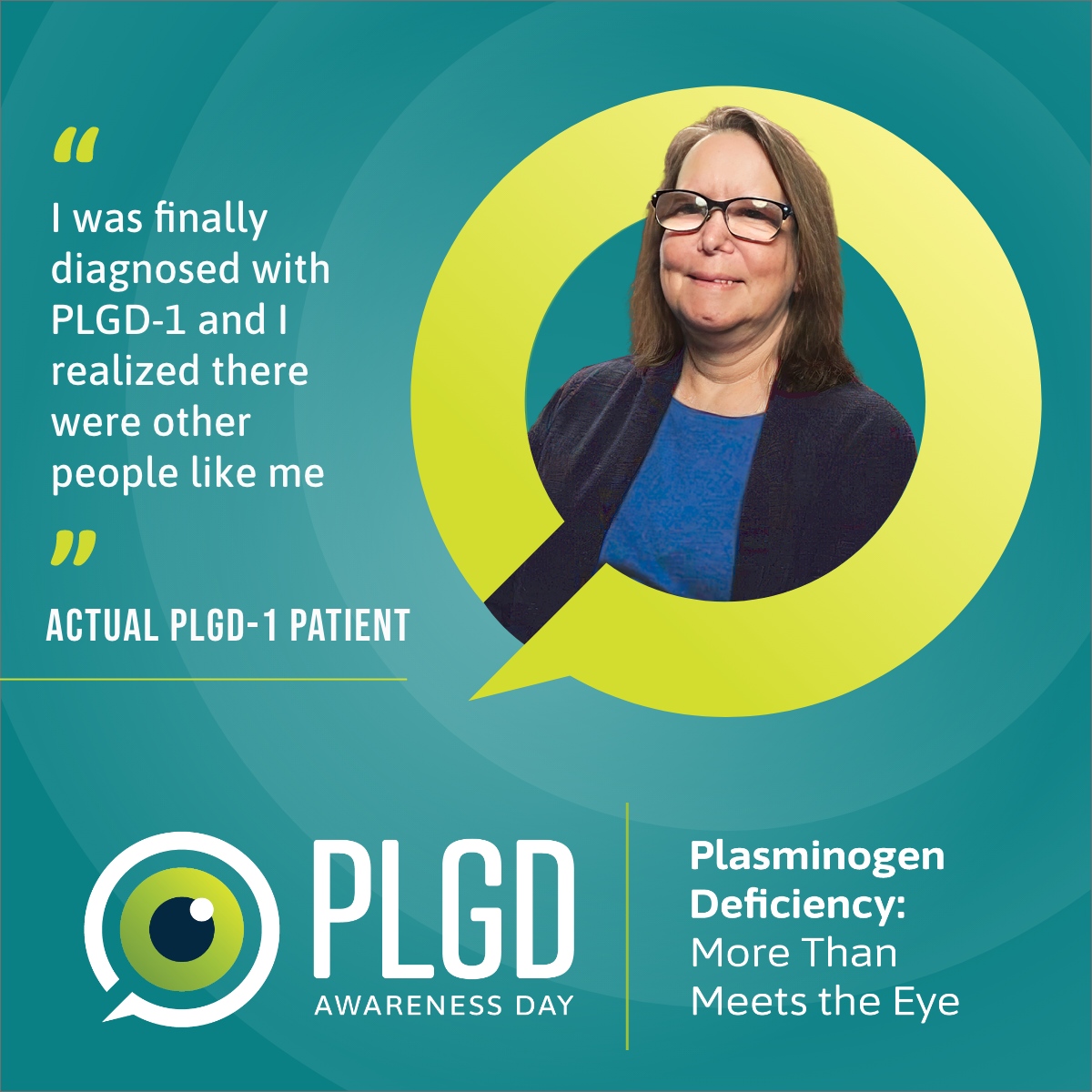 🔎 PLGD-1: Rare, but Recognizable🔍

Kedrion Biopharma is recognizing Plasminogen Deficiency Awareness Day on May 5th. Plasminogen Deficiency Type 1 (PLGD-1) is a rare genetic disorder, affecting an estimated 500 people in the U.S. It causes ligneous lesions to form throughout