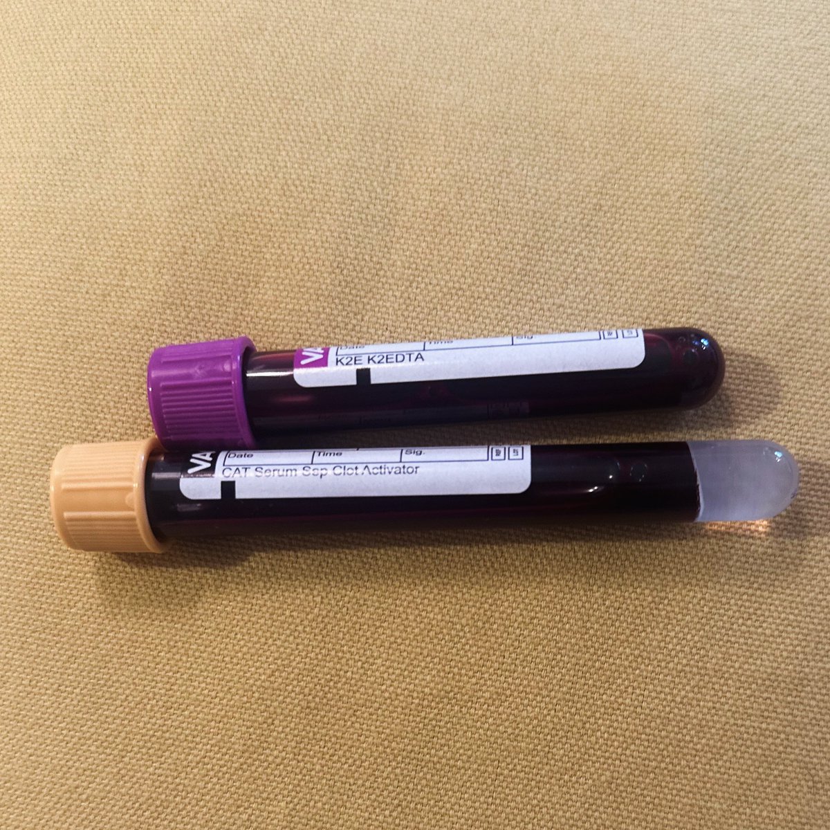 TheLighthouseCe's tweet photo. Today’s reason to smile……….getting blood out of that stone #Blood #Vampire #GoodBleeder #Stone xxx https://t.co/3bbh314gi1