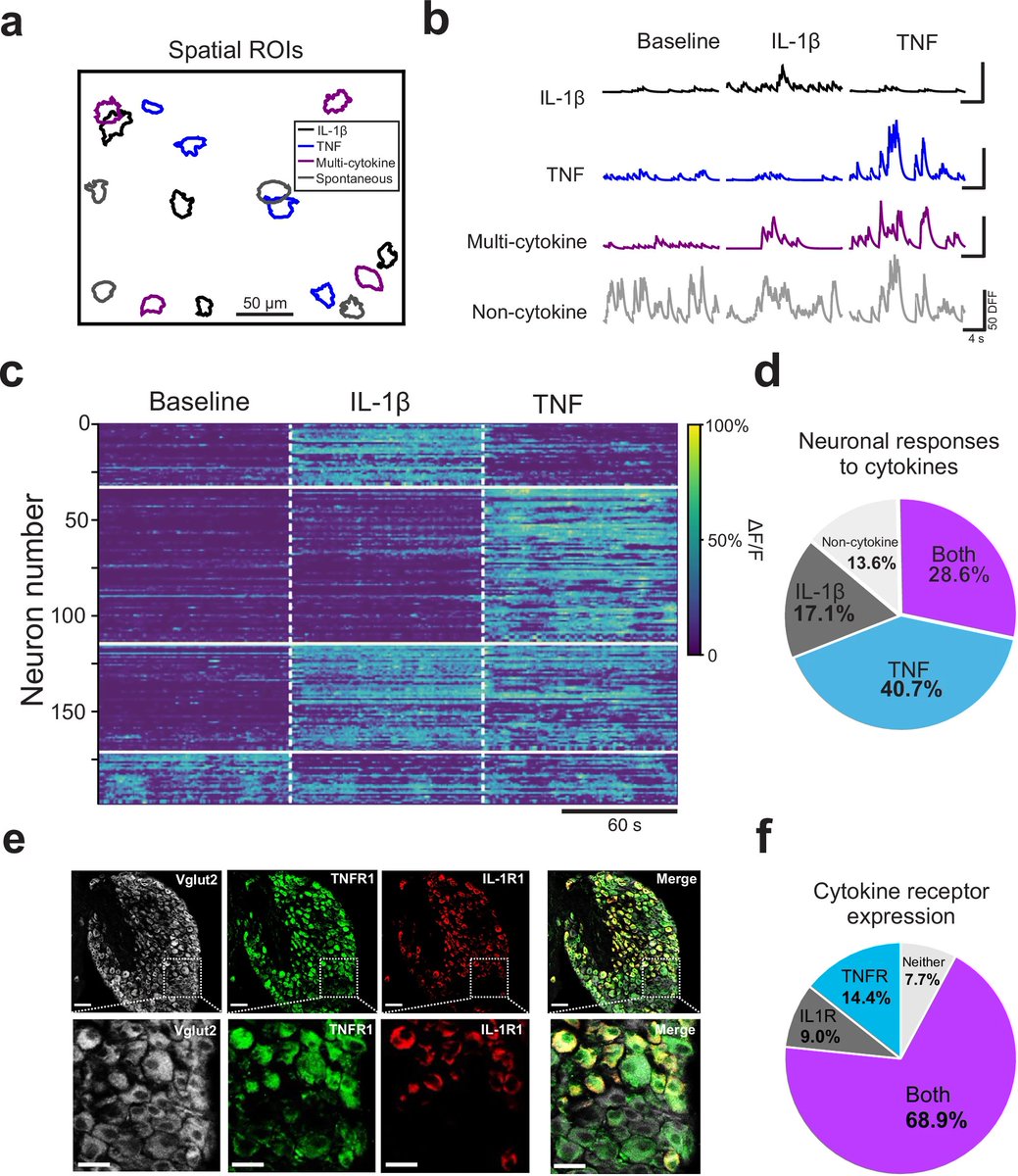 Waggoner Lab (@labwaggoner) on Twitter photo Neural representation of cytokines by vagal sensory neurons <a href="/NatureComms/">Nature Communications</a> <a href="/changsbrain/">Eric H Chang</a> <a href="/KevinJTraceyMD/">Prof. Kevin J. Tracey, MD</a>
nature.com/articles/s4146… Neural representation of cytokines by vagal sensory neurons <a href="/NatureComms/">Nature Communications</a> <a href="/changsbrain/">Eric H Chang</a> <a href="/KevinJTraceyMD/">Prof. Kevin J. Tracey, MD</a>
nature.com/articles/s4146…