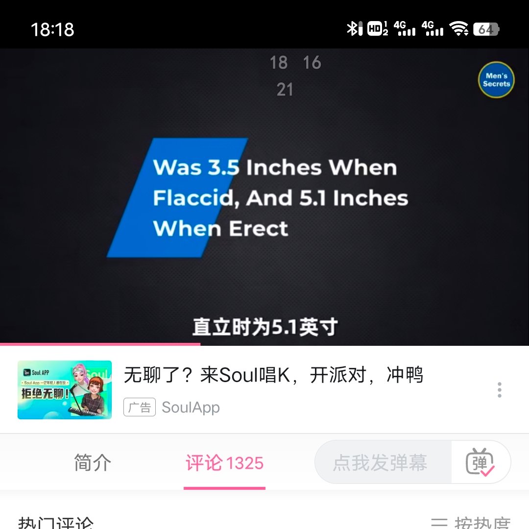 wfjs1482641's tweet photo. @likeabirdde @wfhnwfhn91 @ganyaojiang 真臭嘴啊夏树，去看看国外研究，图3.4图片里的论文链接自己去看看，国外就是5.1英寸左右，约12.95cm ，乱喷什么呢，论文的测量数据就在这， https://t.co/80NIvbhZ7H