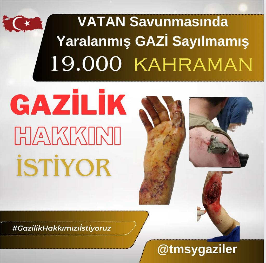 T M Y S Hüseyin Sarıtaş (@hseyinsaritas05) on Twitter photo 🇹🇷VATAN🇹🇷
KURŞUN YEDİK
MAYIN YEDİK
👇
#GazilikHakkımızıİstiyoruz
☝️
<a href="/RTErdogan/">Recep Tayyip Erdoğan</a>
<a href="/_cevdetyilmaz/">Cevdet Yılmaz</a>
<a href="/dbdevletbahceli/">Devlet Bahçeli</a>
<a href="/eczozgurozel/">Özgür Özel</a>
<a href="/MahinurOzdemir/">Mahinur Özdemir Göktaş</a>
<a href="/drbetulsayan/">Dr.Betül Sayan Kaya 🇹🇷</a>
<a href="/avabdullahguler/">Abdullah Güler</a>
<a href="/FeyziBerdibek1/">Feyzi Berdibek🇹🇷</a>
<a href="/celebimehmeta/">Mehmet Ali Çelebi</a>
<a href="/ifarukaksu/">İsmail Faruk Aksu</a>
<a href="/kocakkonuralp/">Konur Alp Koçak</a>
<a href="/SayimMadak/">Dr. Sevim Sayım Madak 🇹🇷</a>
<a href="/leventalyyildiz/">Levent Ali YILDIZ</a>
<a href="/mhrmkurt/">Muharrem KURT</a> 🇹🇷VATAN🇹🇷
KURŞUN YEDİK
MAYIN YEDİK
👇
#GazilikHakkımızıİstiyoruz
☝️
<a href="/RTErdogan/">Recep Tayyip Erdoğan</a>
<a href="/_cevdetyilmaz/">Cevdet Yılmaz</a>
<a href="/dbdevletbahceli/">Devlet Bahçeli</a>
<a href="/eczozgurozel/">Özgür Özel</a>
<a href="/MahinurOzdemir/">Mahinur Özdemir Göktaş</a>
<a href="/drbetulsayan/">Dr.Betül Sayan Kaya 🇹🇷</a>
<a href="/avabdullahguler/">Abdullah Güler</a>
<a href="/FeyziBerdibek1/">Feyzi Berdibek🇹🇷</a>
<a href="/celebimehmeta/">Mehmet Ali Çelebi</a>
<a href="/ifarukaksu/">İsmail Faruk Aksu</a>
<a href="/kocakkonuralp/">Konur Alp Koçak</a>
<a href="/SayimMadak/">Dr. Sevim Sayım Madak 🇹🇷</a>
<a href="/leventalyyildiz/">Levent Ali YILDIZ</a>
<a href="/mhrmkurt/">Muharrem KURT</a>