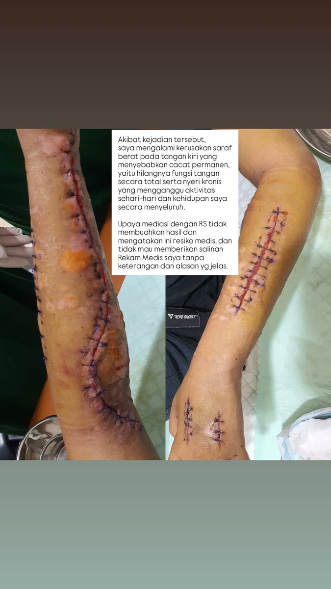 F4rizfirmansyah's tweet photo. KRONOLOGI
[2/4] https://t.co/2T0EGTJE58