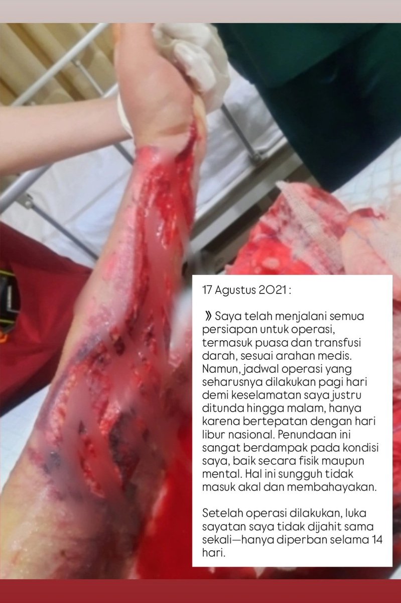 F4rizfirmansyah's tweet photo. KRONOLOGI
[2/4] https://t.co/2T0EGTJE58