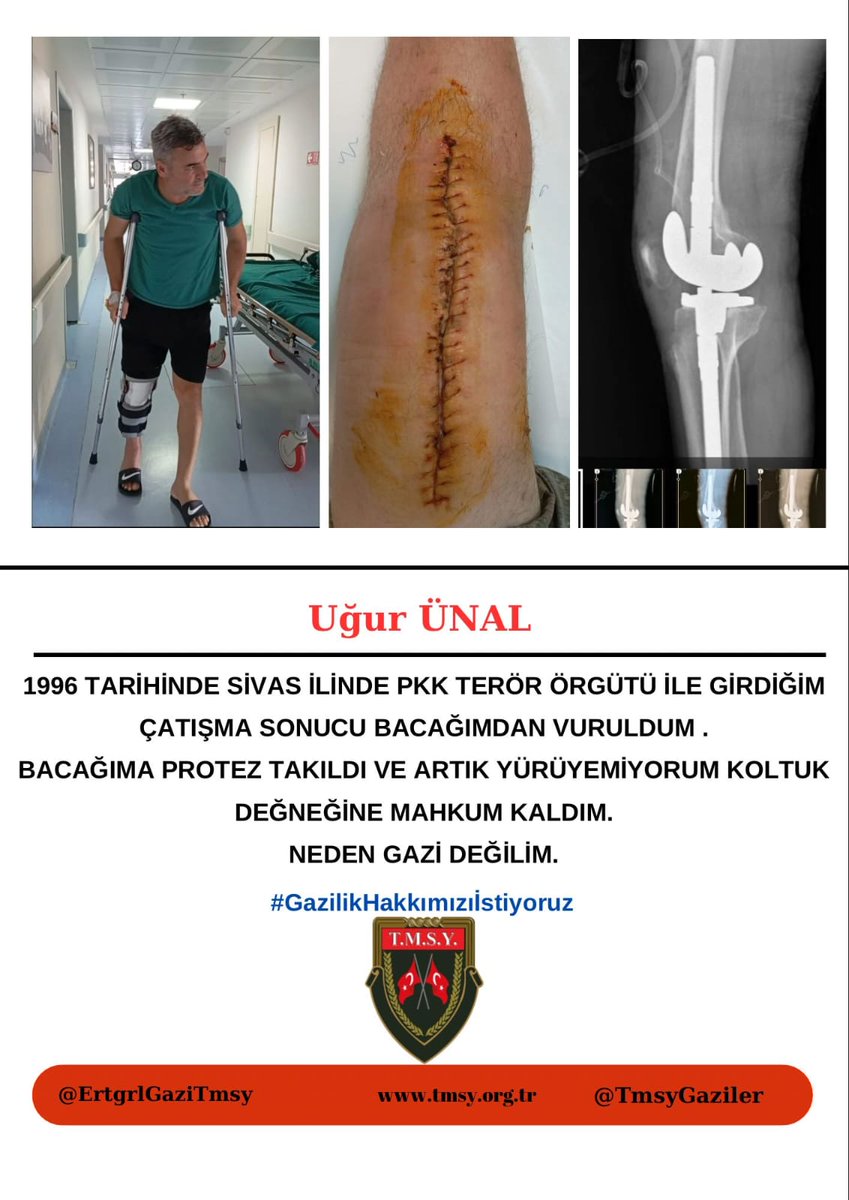TMSY Uğur Ünal (@gazisayilmayan) on Twitter photo 🇹🇷DEVLET🇹🇷
MAYIN YEDİK
KURŞUN YEDİK SAKAT KALDIK
#GazilikHakkımızıİstiyoruz
<a href="/RTErdogan/">Recep Tayyip Erdoğan</a>
<a href="/drbetulsayan/">Dr.Betül Sayan Kaya 🇹🇷</a> <a href="/dbdevletbahceli/">Devlet Bahçeli</a>
<a href="/MahinurOzdemir/">Mahinur Özdemir Göktaş</a>
<a href="/FeyziBerdibek1/">Feyzi Berdibek🇹🇷</a>
<a href="/avabdullahguler/">Abdullah Güler</a>
<a href="/celebimehmeta/">Mehmet Ali Çelebi</a>
<a href="/ifarukaksu/">İsmail Faruk Aksu</a>
<a href="/kocakkonuralp/">Konur Alp Koçak</a>
<a href="/SayimMadak/">Dr. Sevim Sayım Madak 🇹🇷</a>
<a href="/leventalyyildiz/">Levent Ali YILDIZ</a>
<a href="/mhrmkurt/">Muharrem KURT</a> 🇹🇷DEVLET🇹🇷
MAYIN YEDİK
KURŞUN YEDİK SAKAT KALDIK
#GazilikHakkımızıİstiyoruz
<a href="/RTErdogan/">Recep Tayyip Erdoğan</a>
<a href="/drbetulsayan/">Dr.Betül Sayan Kaya 🇹🇷</a> <a href="/dbdevletbahceli/">Devlet Bahçeli</a>
<a href="/MahinurOzdemir/">Mahinur Özdemir Göktaş</a>
<a href="/FeyziBerdibek1/">Feyzi Berdibek🇹🇷</a>
<a href="/avabdullahguler/">Abdullah Güler</a>
<a href="/celebimehmeta/">Mehmet Ali Çelebi</a>
<a href="/ifarukaksu/">İsmail Faruk Aksu</a>
<a href="/kocakkonuralp/">Konur Alp Koçak</a>
<a href="/SayimMadak/">Dr. Sevim Sayım Madak 🇹🇷</a>
<a href="/leventalyyildiz/">Levent Ali YILDIZ</a>
<a href="/mhrmkurt/">Muharrem KURT</a>