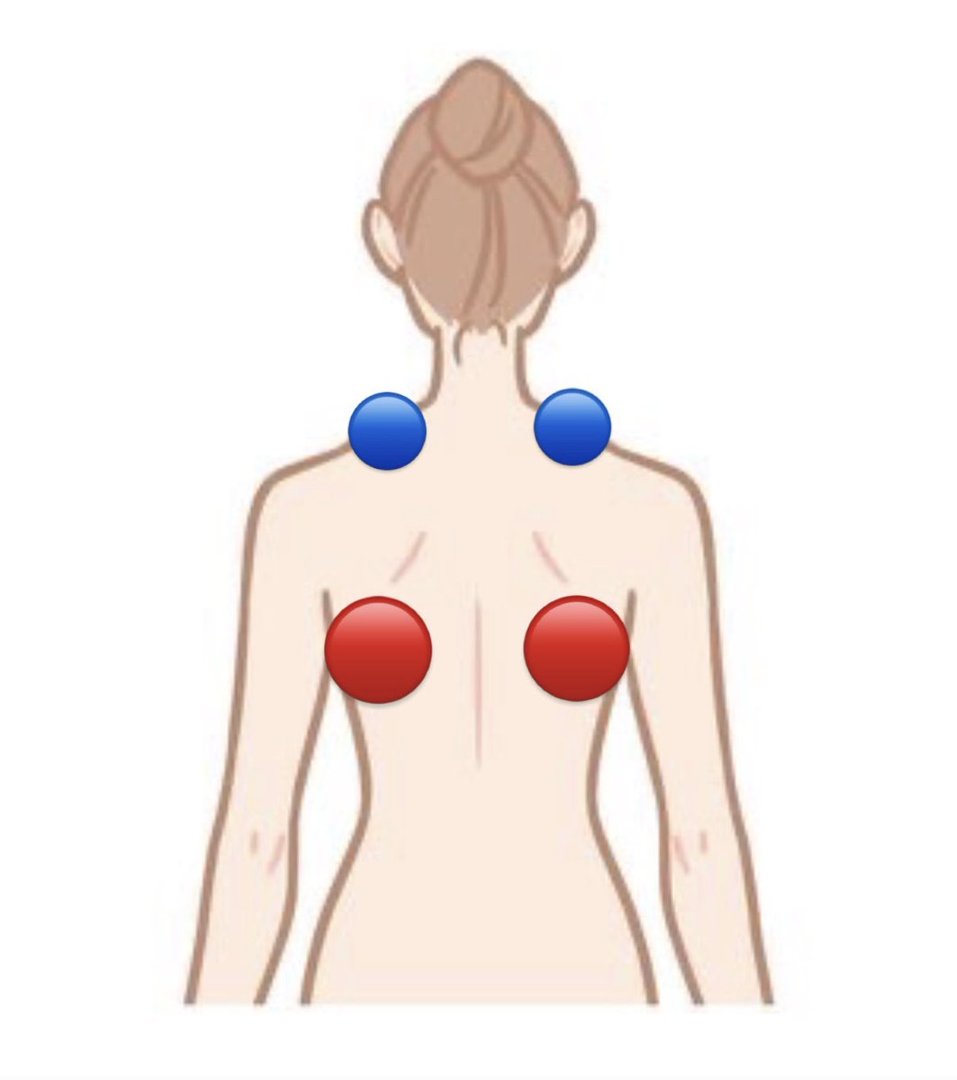 ivl9t's tweet photo. 私もこれの左だったんだけど、ピラティスの先生に「🔴のとこを鍛えると🔵に負担がかからなくなって盛り上がりが消えるよ〜」って言われて試したらモッコリが消えたんだよね　是非赤いとこ鍛えてみてほしい変わるから😭 https://t.co/TRss88IIXU