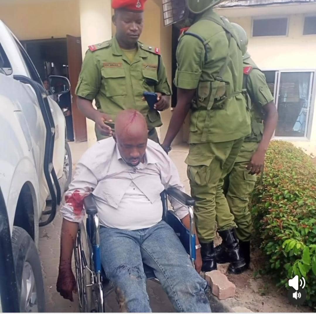 MosesSteven13's tweet photo. Polisi wanateka, wanavunja wa tz   miguu na mikono , wanaua na kudhalilisha wa tanganyika kwa kuwapiga na kuwatupa maporin ilikutetea ccm na serikali yao ,Niwakati wakuitetea tanganyika na watanganyika kwa style hiyo hiyo babu zetu walifanikiwa kwa wakoloni weus hi nizamu yetu https://t.co/rdOhpLyxcN