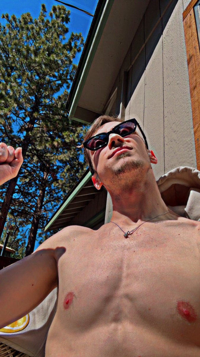 Recovering after getting a Tooth pulled 🤕😮‍💨😘