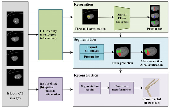 Sensors_MDPI's tweet photo. An Automatic Method for Elbow Joint Recognition, Segmentation and Reconstruction
https://t.co/c4VeflYsO7
#medicalimagesegmentation https://t.co/008d0V2Qbt
