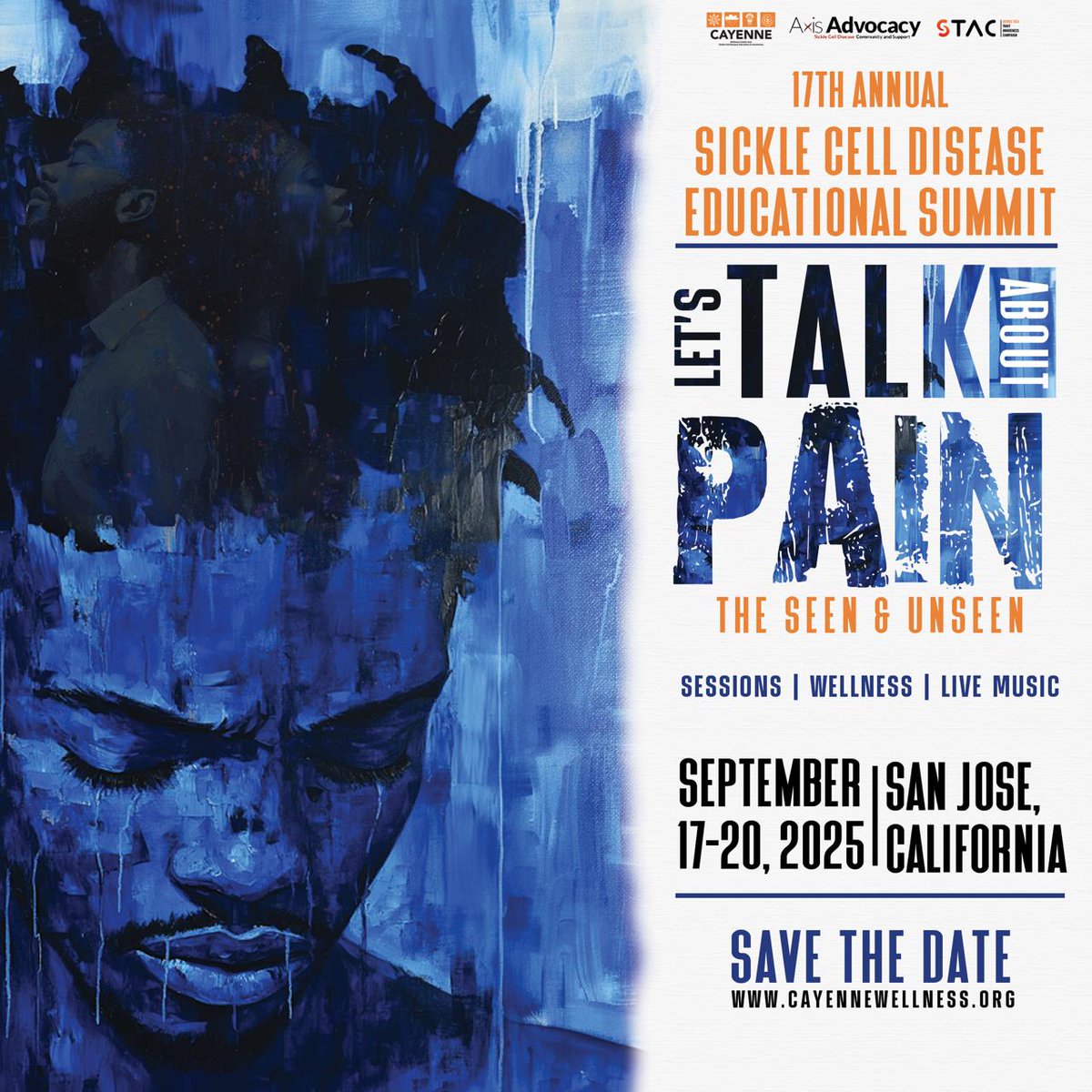 San Jose, CA
📅 Sept 17–20, 2025
We’re talking about the pain we see—and the pain we don’t.

Join the 17th Annual Sickle Cell Disease Educational Summit:
Let’s Talk About Pain: The Seen &amp; Unseen

🎶 Sessions. Wellness. Live music.

#SickleCellSummit #LetsTalkAboutPain #SCD2025